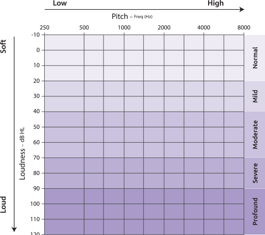 Example audiogram chart showing hearing levels from soft to profound